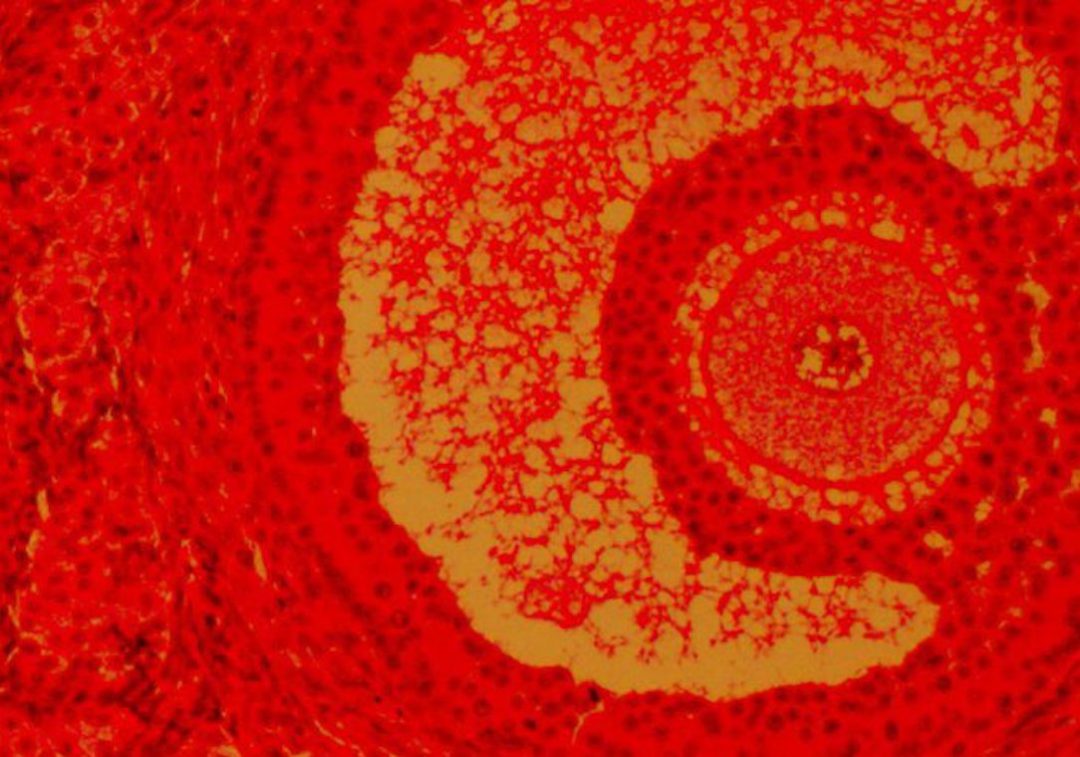 CareNet seminar: “How about we stop calling it ‘egg donation’? From assisted reproduction techniques to reproductive capacity transfer”, by Sara Lafuente (CSIC)